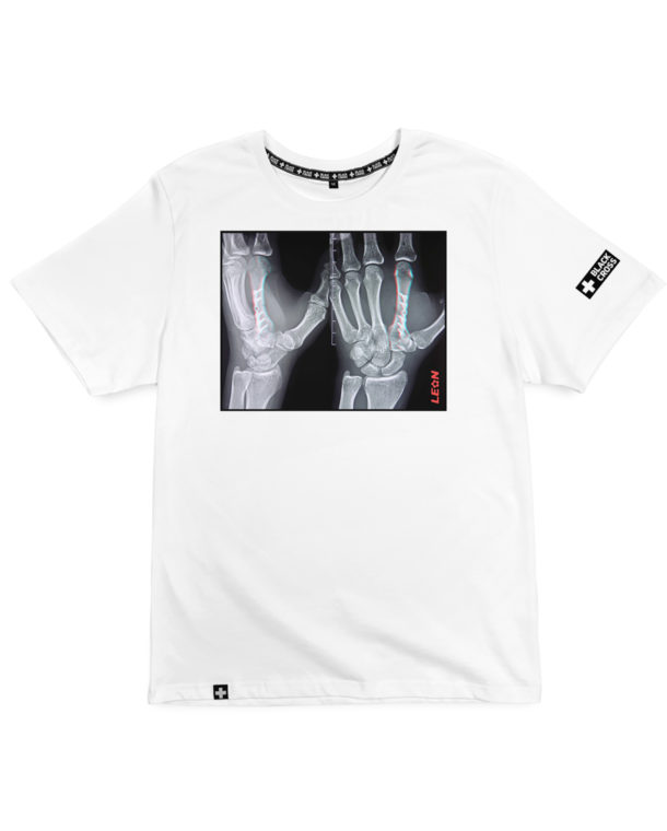 print Рентген